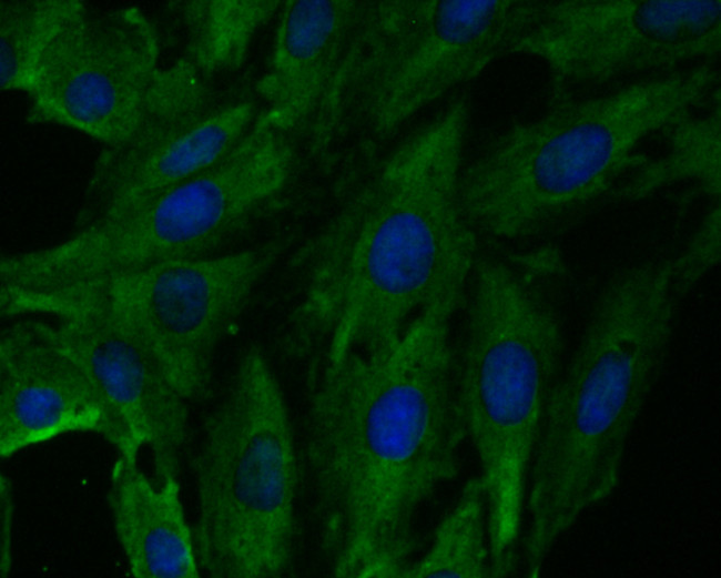 Fbx32 Antibody in Immunocytochemistry (ICC/IF)