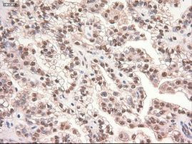 c-Myc Antibody in Immunohistochemistry (Paraffin) (IHC (P))