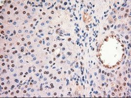 c-Myc Antibody in Immunohistochemistry (Paraffin) (IHC (P))