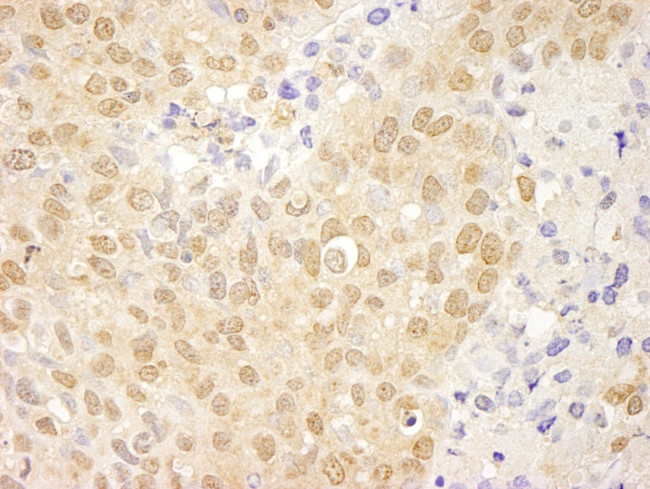 cAbl Antibody in Immunohistochemistry (IHC)