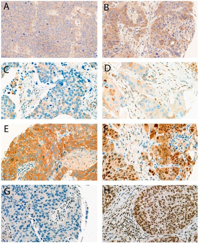 HMGB1 Antibody in Immunohistochemistry (IHC)