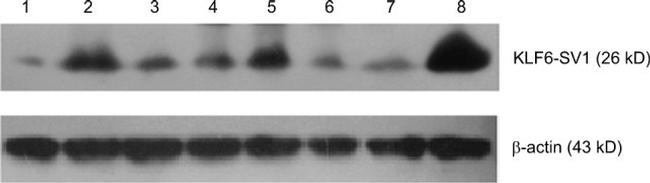 KLF6 Antibody in Western Blot (WB)