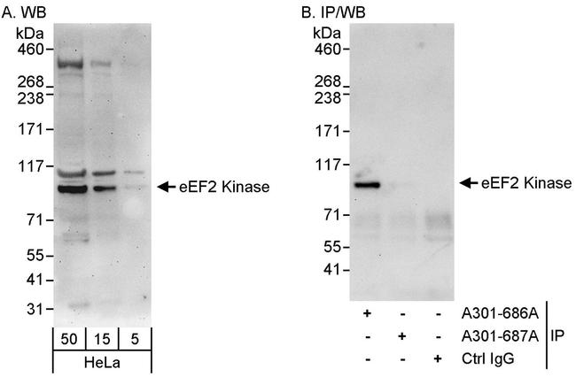 eEF2 Kinase Antibody in Western Blot (WB)