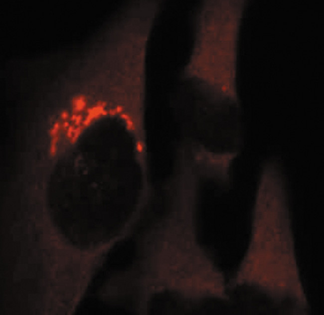 EEF2K Antibody in Immunocytochemistry (ICC/IF)