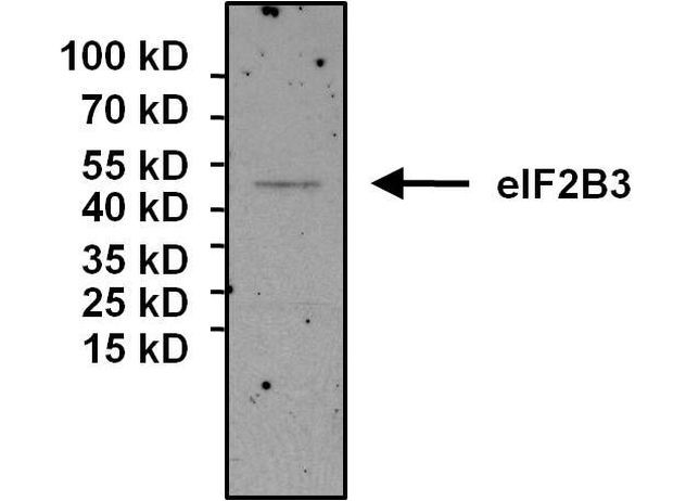 eIF2b gamma Antibody in Immunoprecipitation (IP)