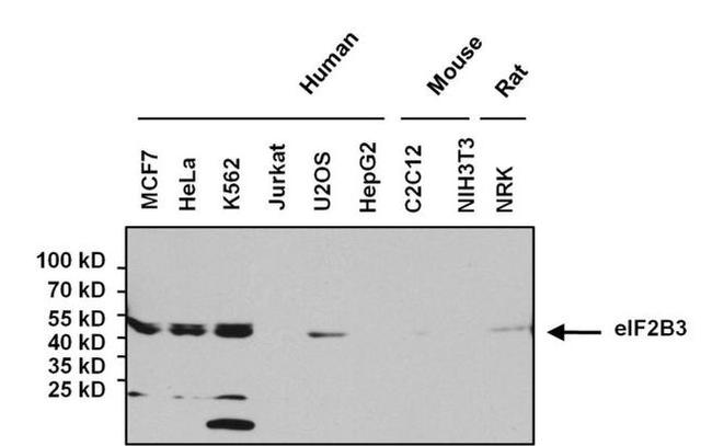 eIF2b gamma Antibody in Western Blot (WB)