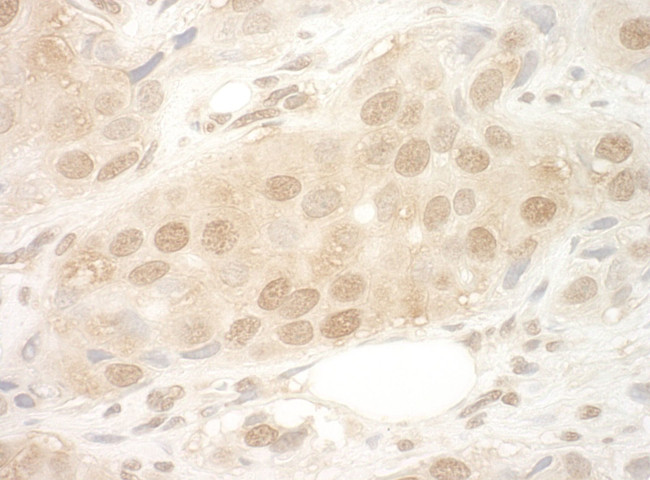 eIF2B5 Antibody in Immunohistochemistry (IHC)