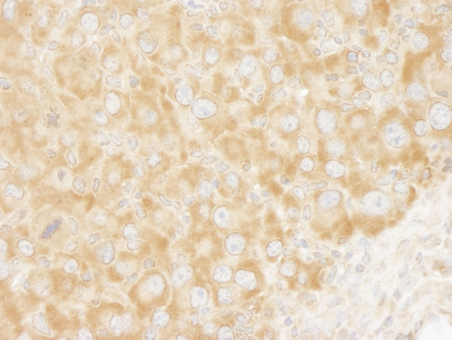 eIF3A/eIF3S10 Antibody in Immunohistochemistry (IHC)