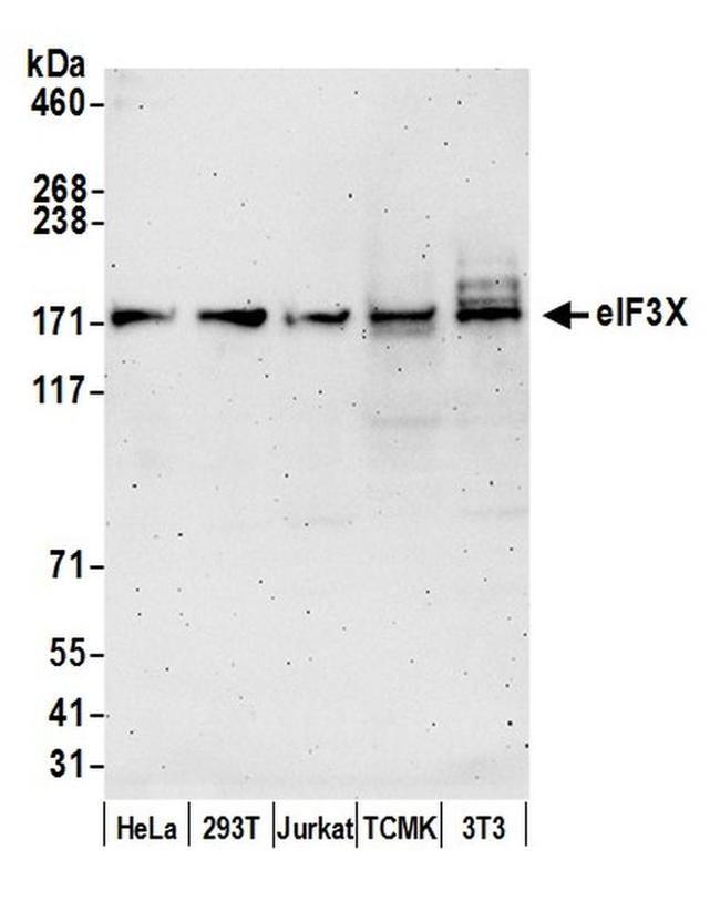 eIF3X Antibody in Western Blot (WB)