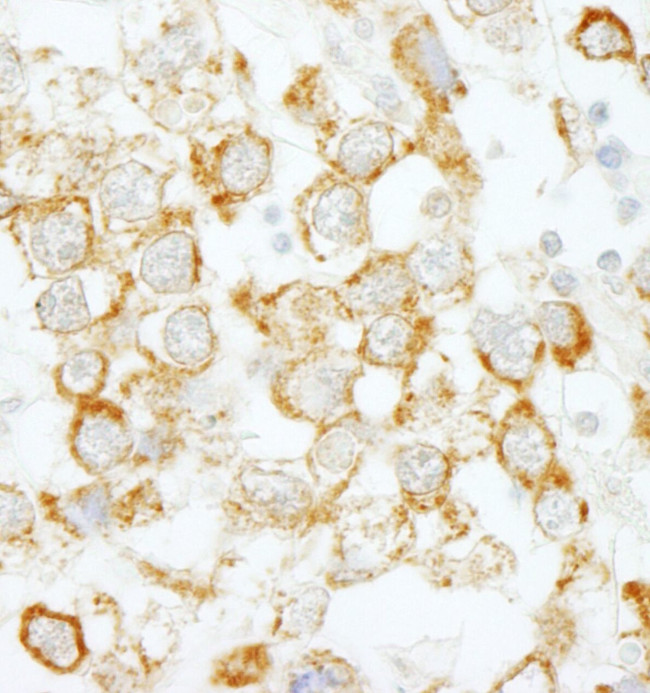 eIF4H Antibody in Immunohistochemistry (IHC)