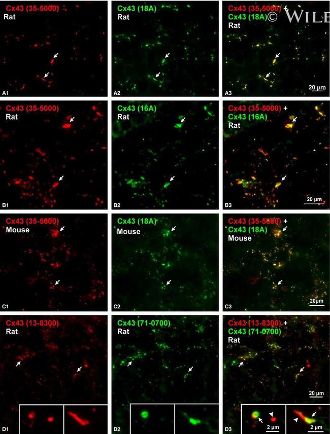 Connexin 43 Antibody in Immunohistochemistry (IHC)