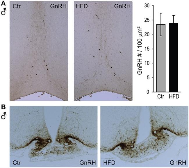 GnRH1 Antibody in Immunohistochemistry (Paraffin) (IHC (P))