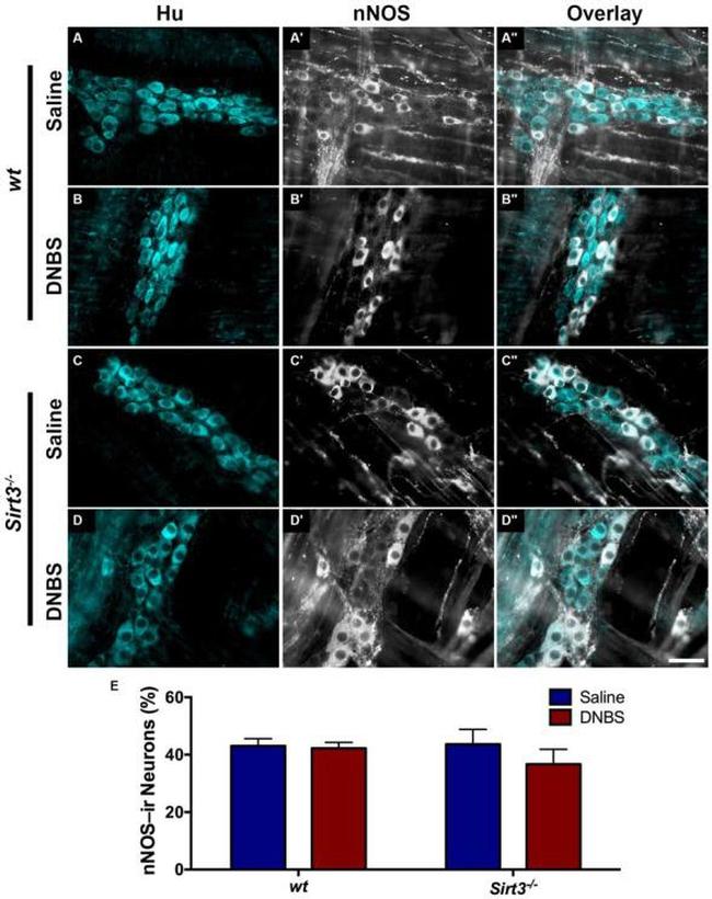 HuC/HuD Antibody in Immunohistochemistry (IHC)