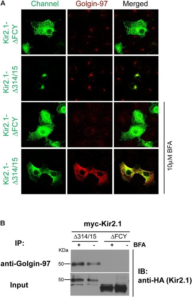 Golgin-97 Antibody in Immunocytochemistry, Immunoprecipitation (ICC/IF, IP)