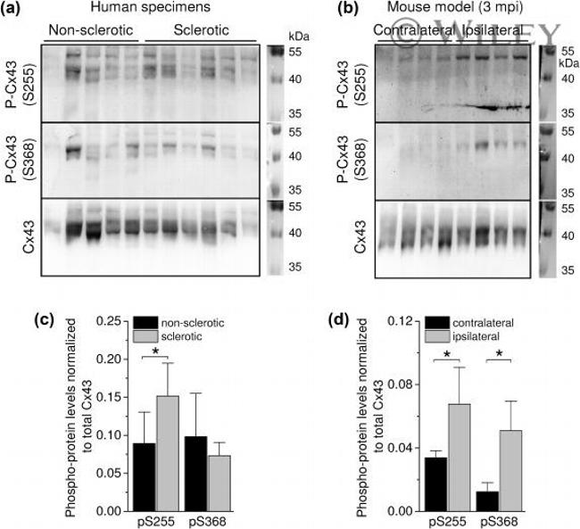 Phospho-Connexin 43 (Ser368) Antibody in Western Blot (WB)