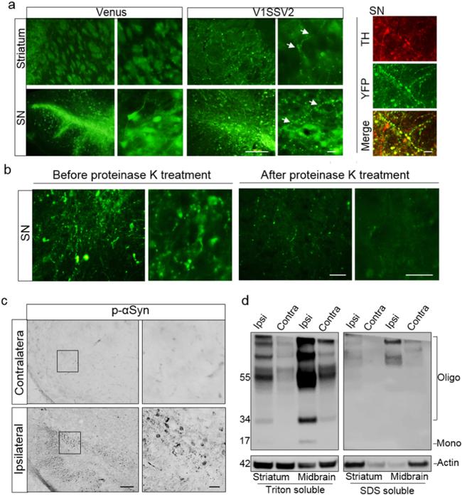 alpha Synuclein Antibody in Western Blot (WB)