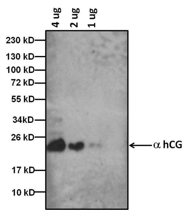 hCG Antibody in Western Blot (WB)