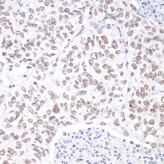 hSET1 Antibody in Immunohistochemistry (IHC)