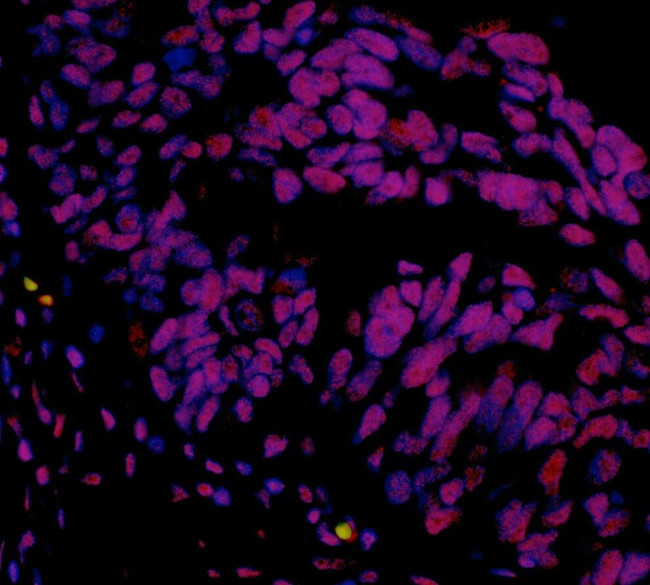 hSET1 Antibody in Immunohistochemistry (IHC)