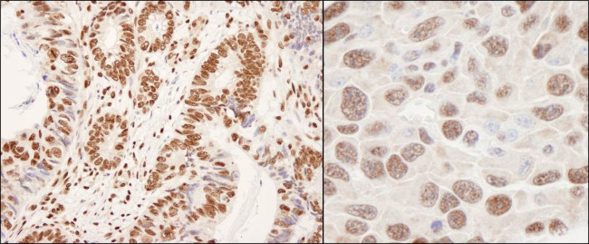 hnRNP-K Antibody in Immunohistochemistry (IHC)