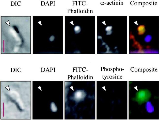 Phosphotyrosine Antibody in Immunocytochemistry (ICC/IF)