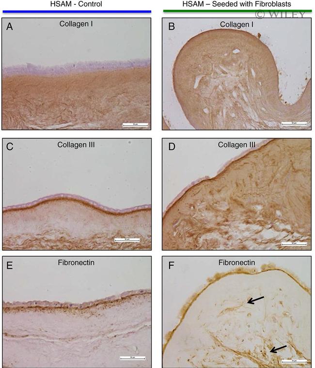 Fibronectin Antibody in Immunohistochemistry (IHC)