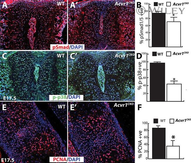 PCNA Antibody in Immunohistochemistry (IHC)