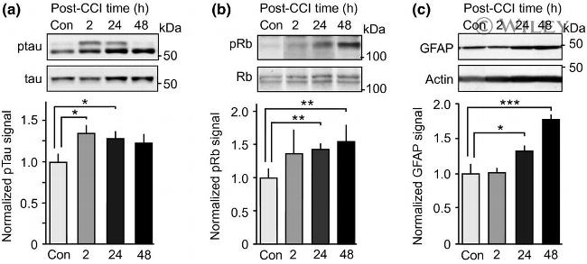 GFAP Antibody in Western Blot (WB)