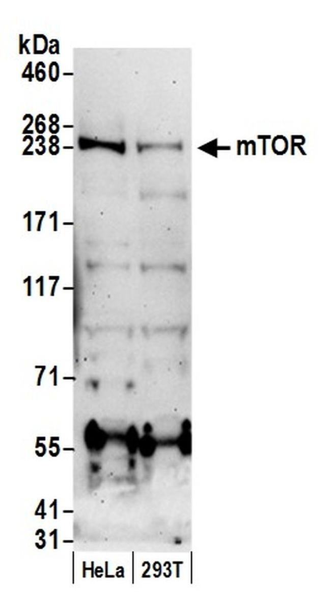 mTOR Polyclonal Antibody (A301-144A)