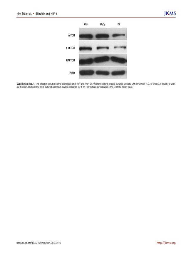 mTOR Antibody in Western Blot (WB)