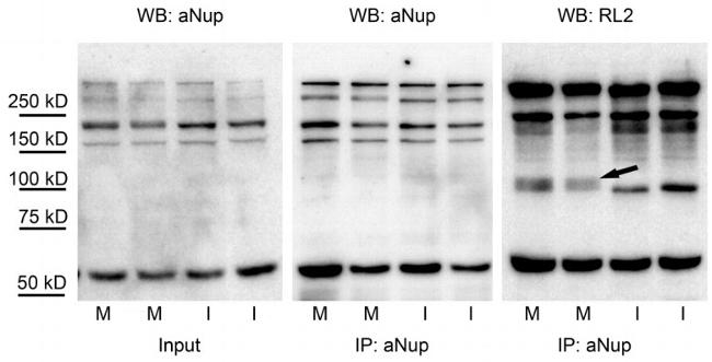 O-linked N-acetylglucosamine (O-GlcNAc) Antibody in Western Blot (WB)