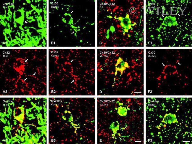 Connexin 43 Antibody in Immunohistochemistry (IHC)