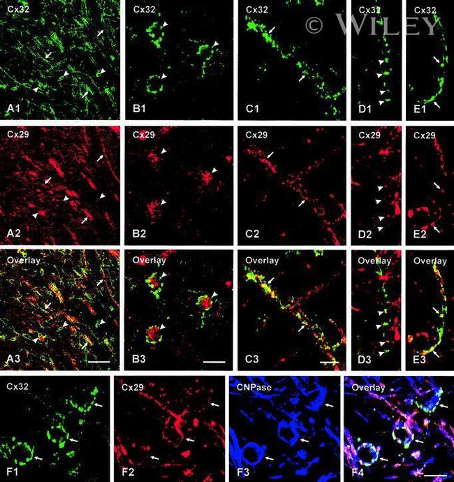 Connexin 32 Antibody in Immunohistochemistry (Frozen) (IHC (F))