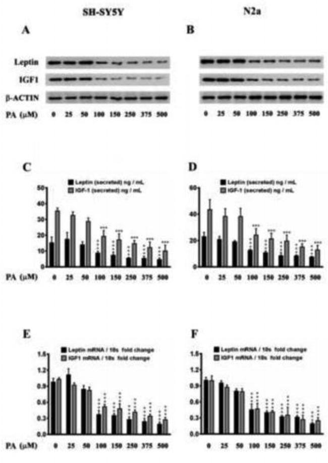 Leptin Antibody in Western Blot, ELISA (WB, ELISA)