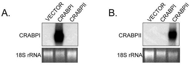 CRABP1 Antibody in Western Blot (WB)