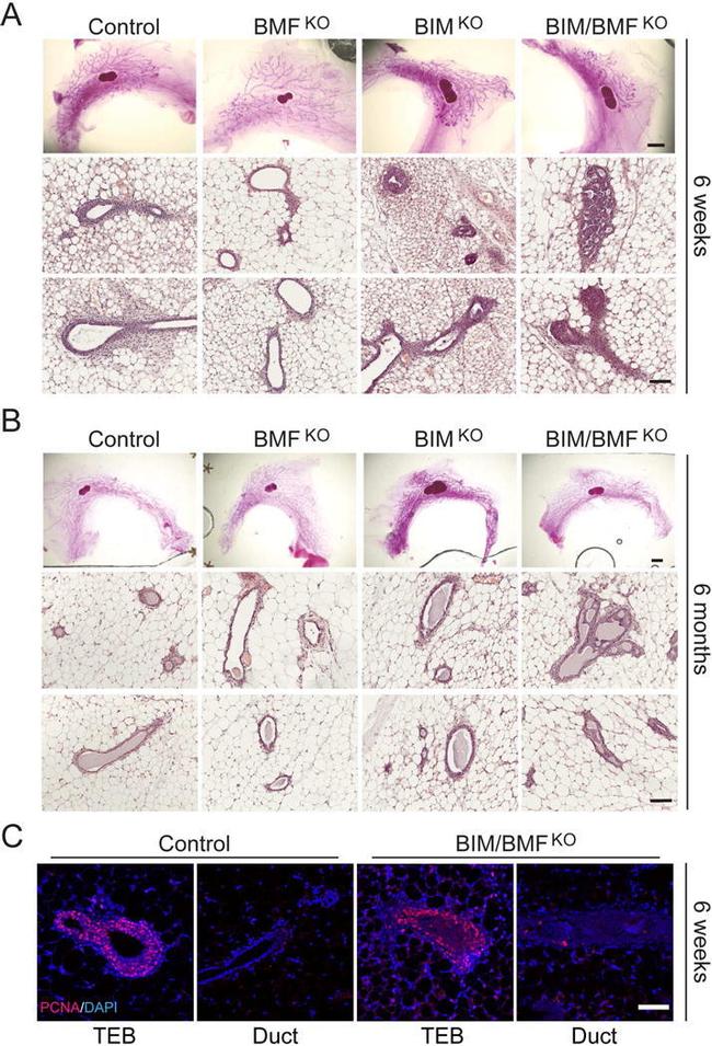 PCNA Antibody in Immunohistochemistry (IHC)