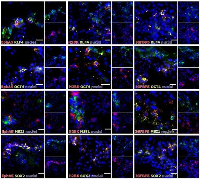 KLF4 Antibody in Immunohistochemistry (IHC)