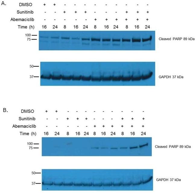 PARP1 (cleaved Asp214, Asp215) Antibody in Western Blot (WB)