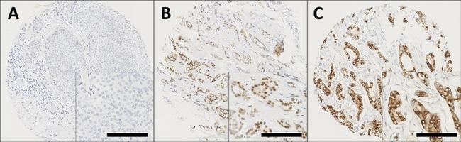 GPR30 Antibody in Immunohistochemistry (IHC)