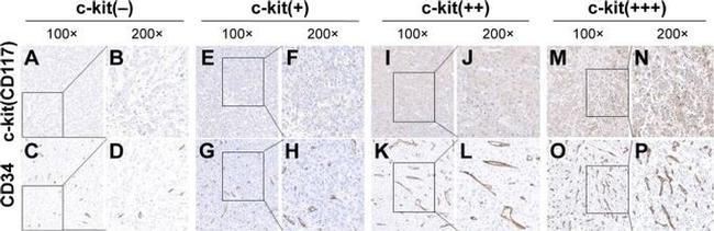 c-Kit Antibody in Immunohistochemistry (IHC)