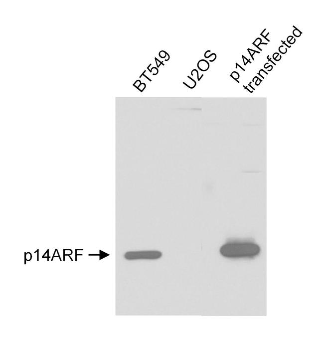 p14ARF Antibody in Western Blot (WB)