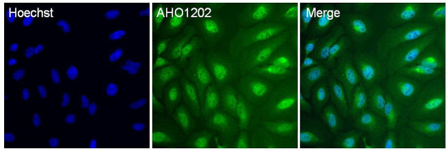 p38 MAPK Polyclonal Antibody (AHO1202)