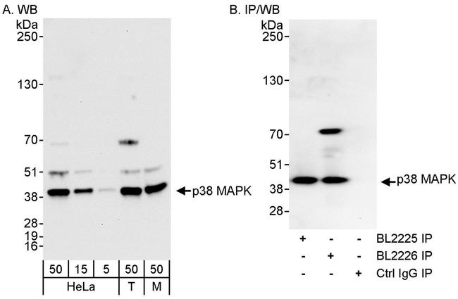 p38 MAPK Antibody in Western Blot (WB)