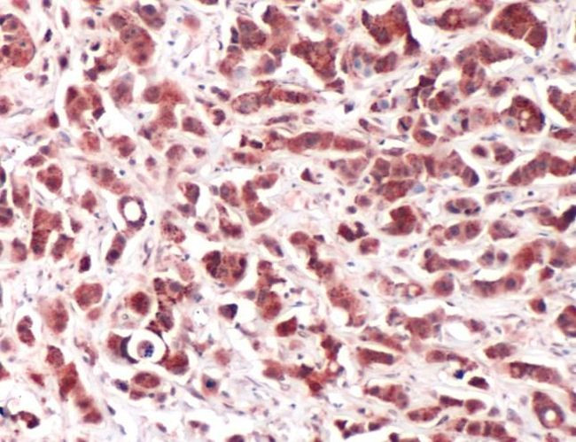 p70 S6 Kinase Antibody in Immunohistochemistry (IHC)