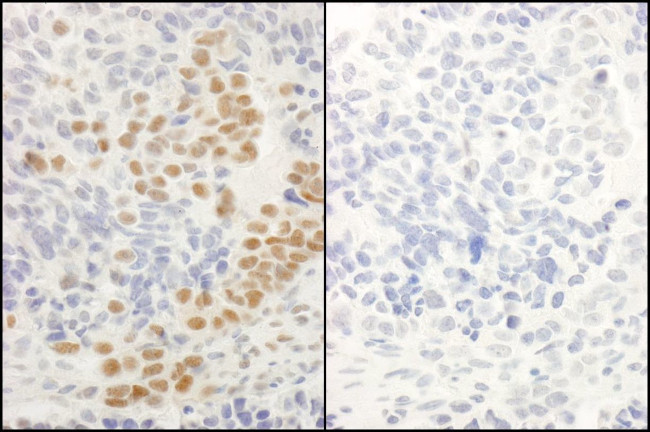 Phospho-RelA (Ser536) Antibody in Immunohistochemistry (IHC)