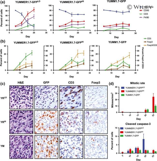 FOXP3 Antibody in Immunohistochemistry (IHC)