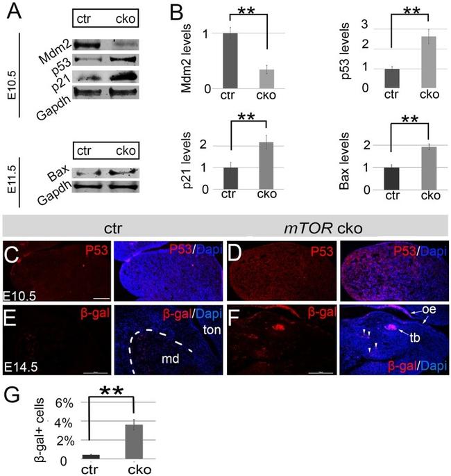 beta Galactosidase Fusion Protein Antibody in Immunohistochemistry (IHC)