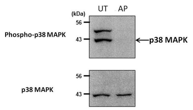 Phospho-p38 MAPK (Thr180, Tyr182) Antibody in Western Blot (WB)