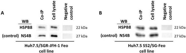 Hepatitis C Virus NS4b Antibody in Western Blot (WB)