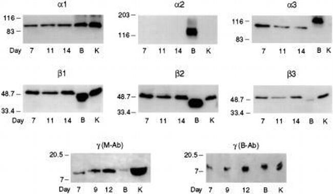 ATP1A3 Antibody in Western Blot (WB)